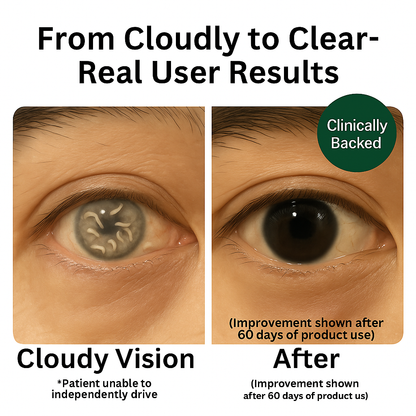 EverVision 14-1 Ultimate Eye Parasite Cleanser