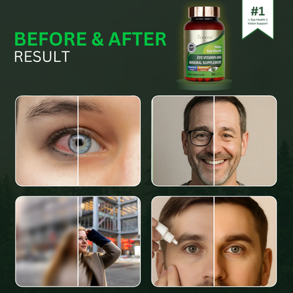 Zoone™ Lutein Eye Vitamins (NEW IMAGES)