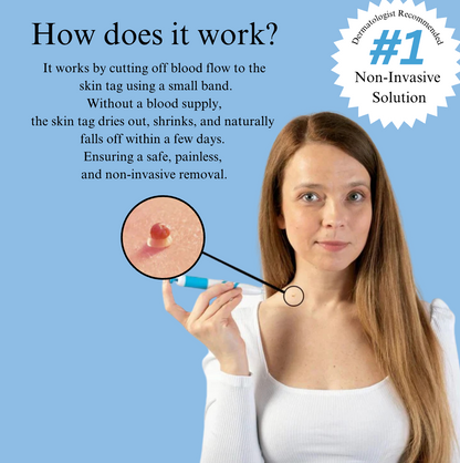 Skin Tag Removal Kit